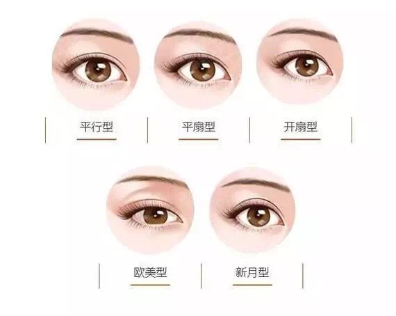 韩式开眼角医院，专业打造美丽双眸的时尚之选