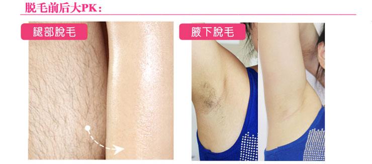 激光脱毛整形美容医院，专业打造美丽新风尚