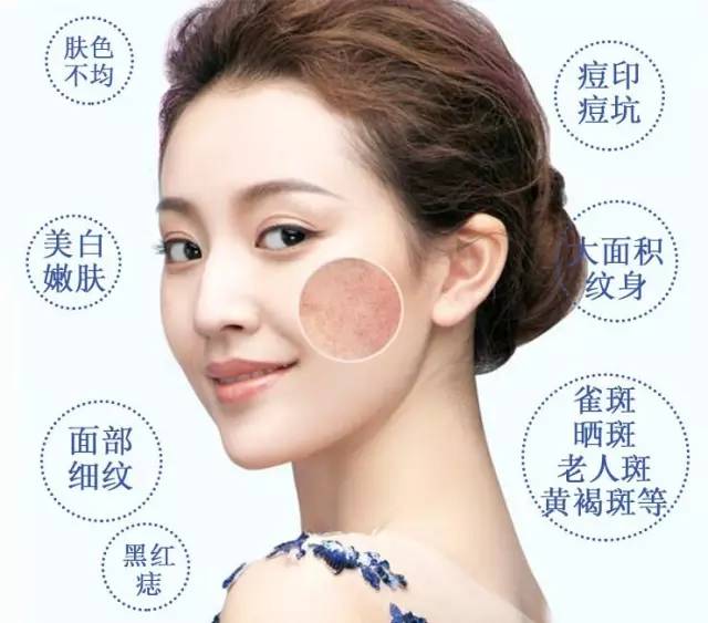 激光除皱医院，重塑青春的科技之光