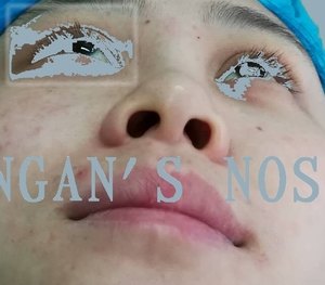 疤痕整形的专业之选，疤痕整形医院