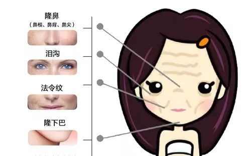 北京除皱价格概览，费用、因素与选择