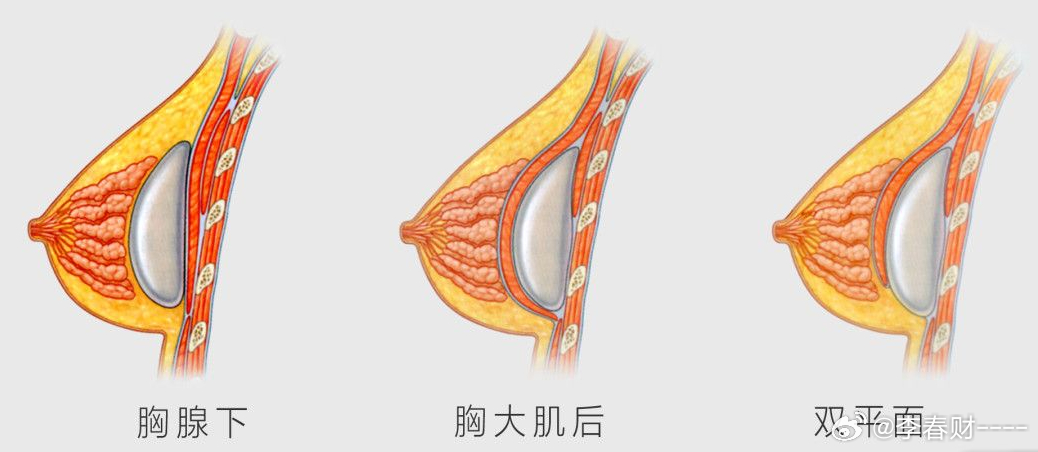丰胸整形美容医院的魅力与重要性