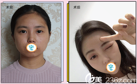 成都整形价格概览