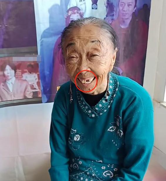 眼部除皱医院，专业打造年轻双眸