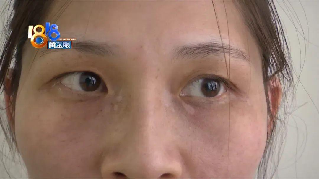 全国光子嫩肤医院排名，探寻最佳光子嫩肤之选