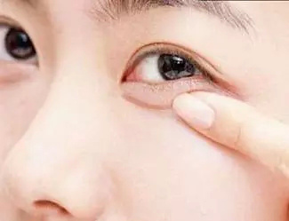 双眼皮塑造，寻找专业整形美容医院的黄金标准