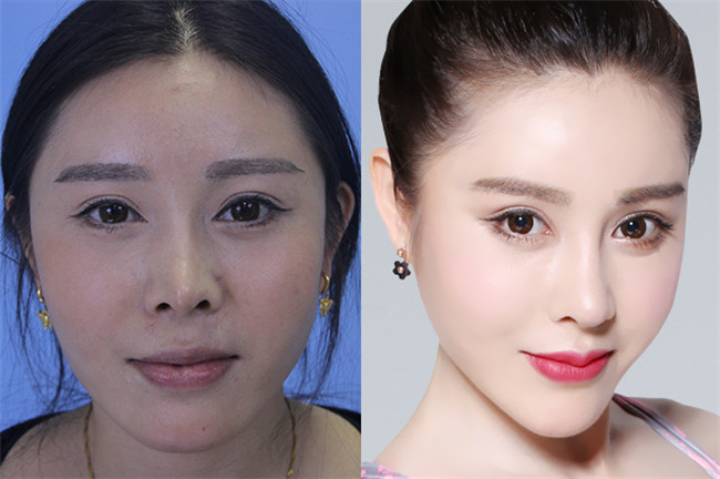 贵阳整形，美丽蜕变的时尚之都