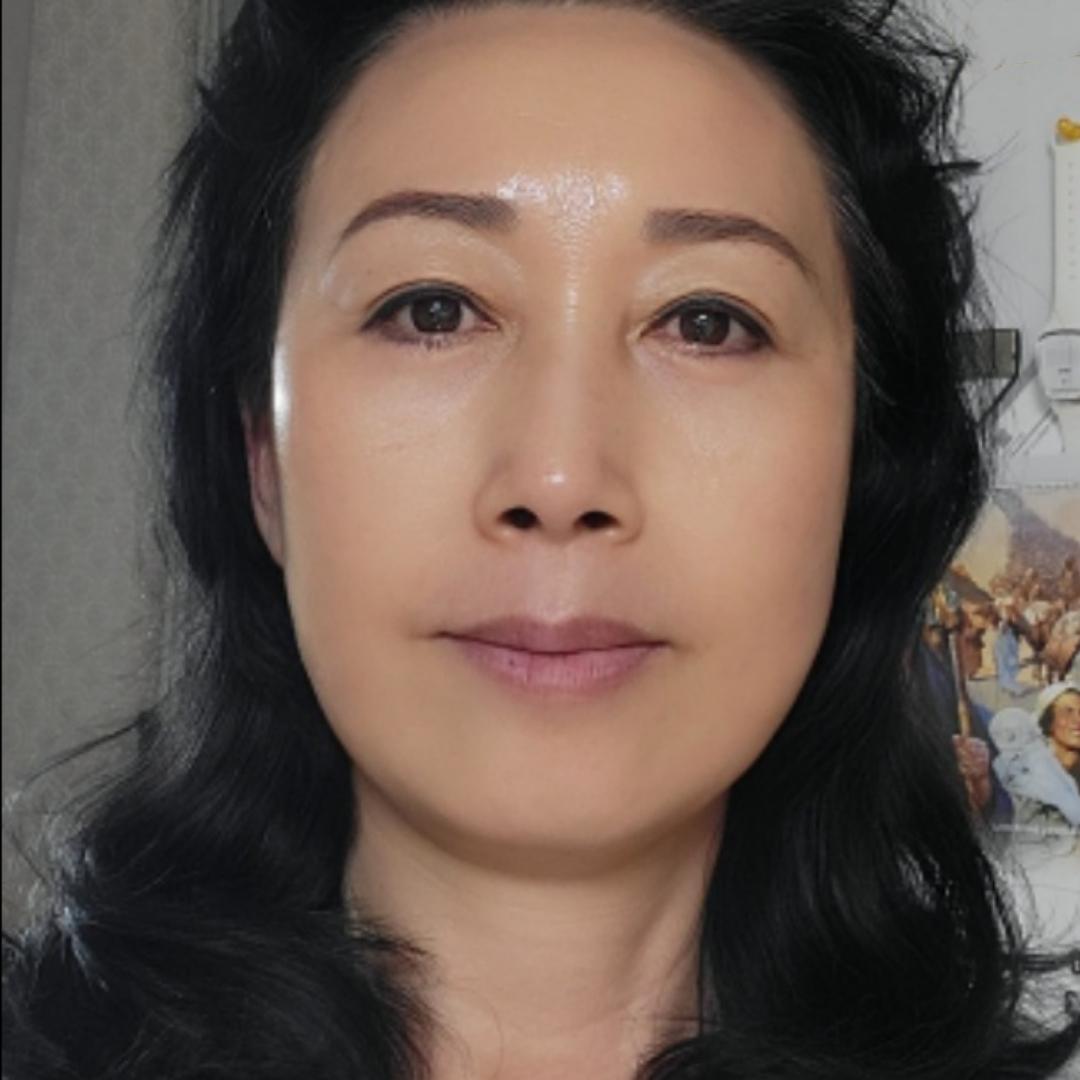 北京去眼袋多少钱，全面解析眼袋去除手术费用及注意事项