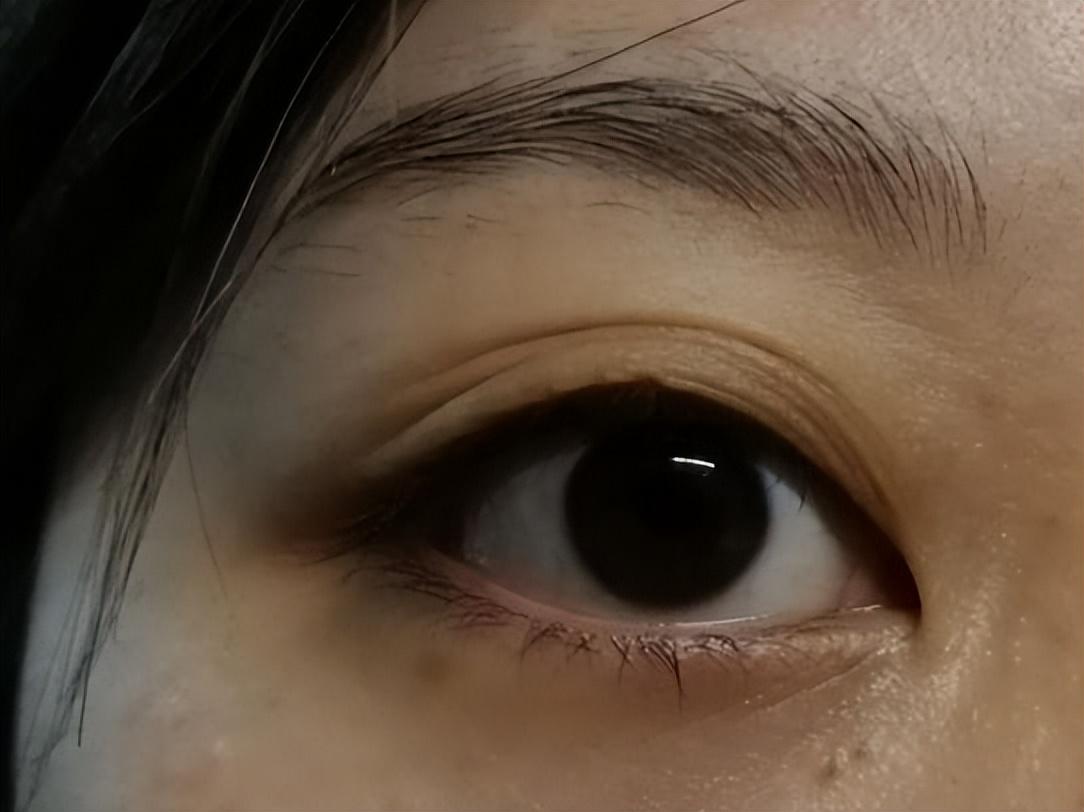 双眼皮塑造，专业割双眼皮医院的选择与体验