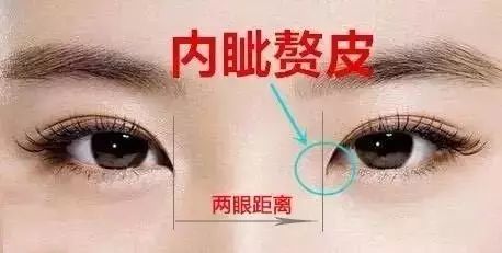北京无痕开眼角，重塑美丽双眸的艺术之旅