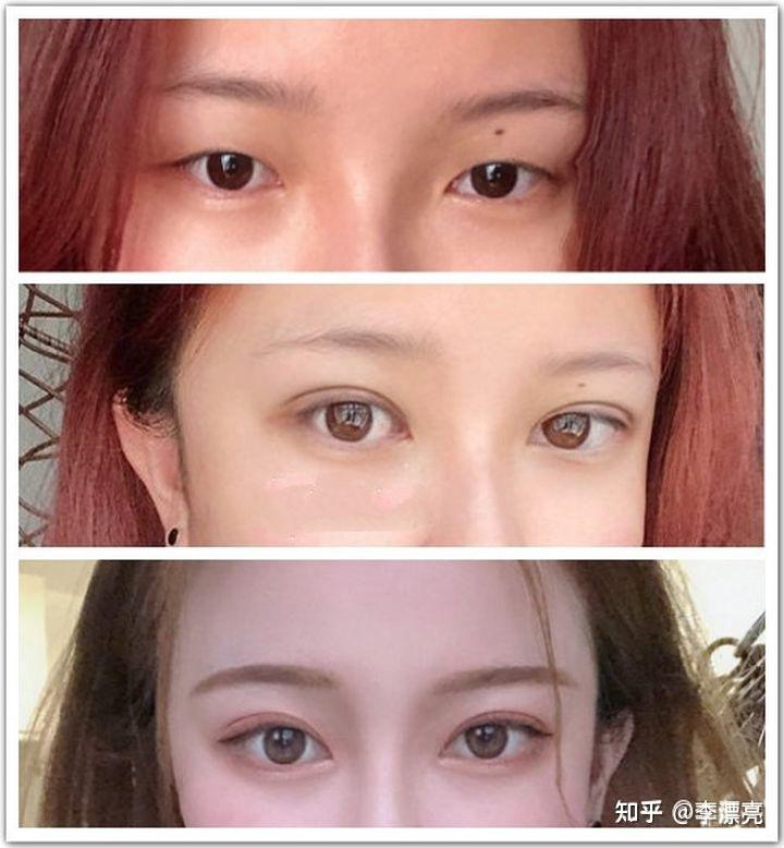 苏州双眼皮的魅力，时尚与美丽的完美结合