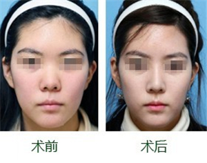 整形整容医生，塑造美丽，传递自信的力量