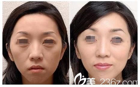 专业打造年轻容颜
