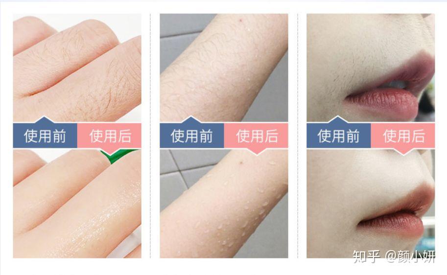 西安脱毛，专业脱毛，美丽新生活的选择