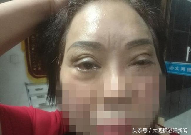 北京哪里割双眼皮好——专业整形美容机构推荐与指南
