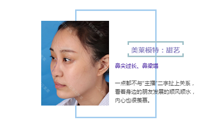 探究最佳整形医院，专业效果与服务品质的综合考量