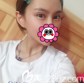 双眼皮修复价格