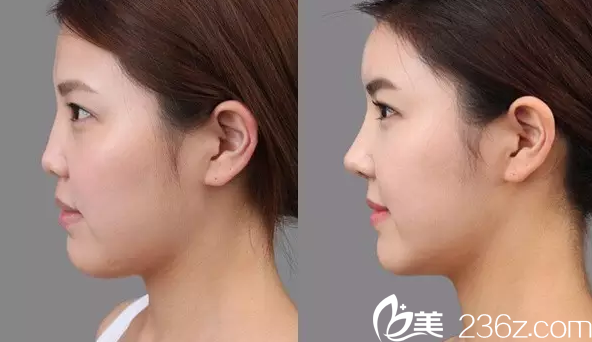 专业塑造美丽（或专业整形）