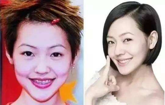 重庆整容，美丽蜕变的背后故事