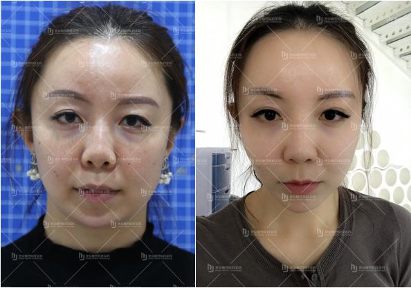 广州美容整容，时尚之都的蜕变艺术