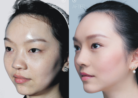 北京最好的美容整形医院——专业、科技与美的完美结合