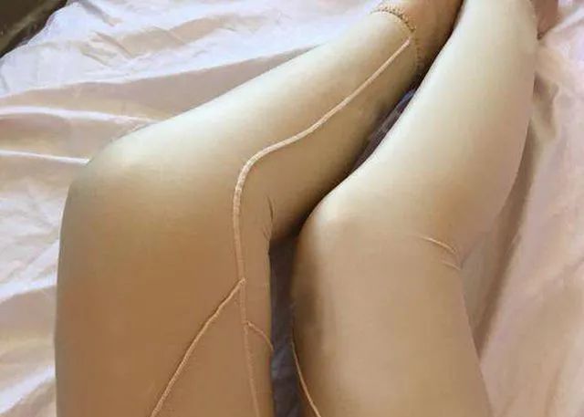 大腿吸脂医院，专业塑形，重塑自信身姿