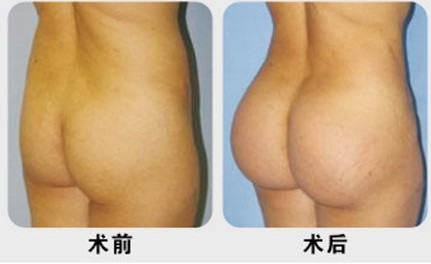 探索现代吸脂减肥瘦身医院，专业、科技与健康的完美结合