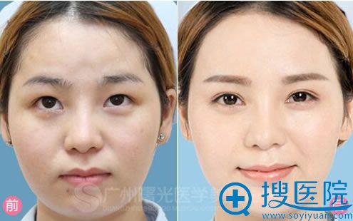 整容医院的选择，哪家整容更好？