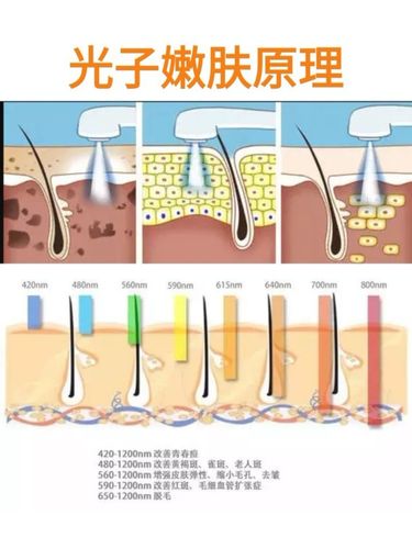 北京光子嫩肤价格，深度解析与全面指导