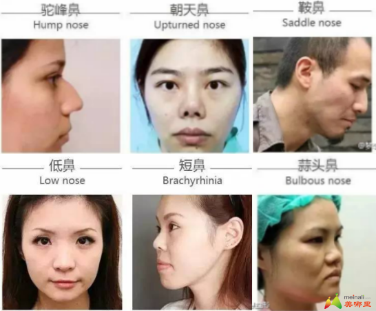 美韩整形，探索两国整形文化的交融与差异
