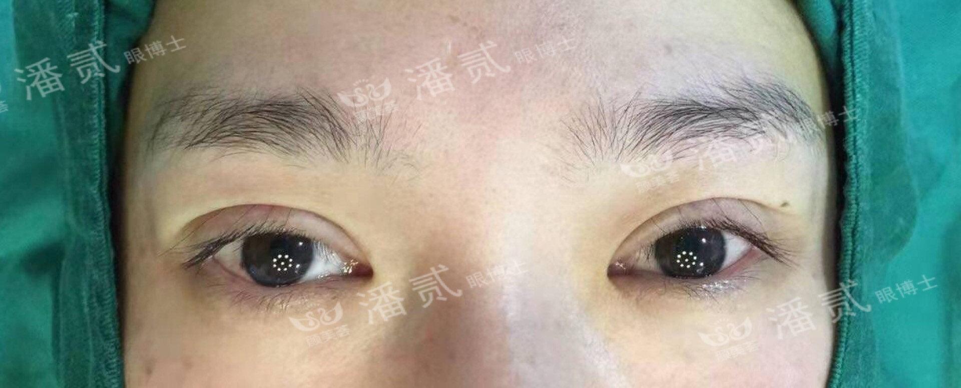 成都眼部整形的魅力与优势