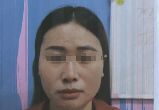 选择专业隆鼻术医院，塑造美丽新高度