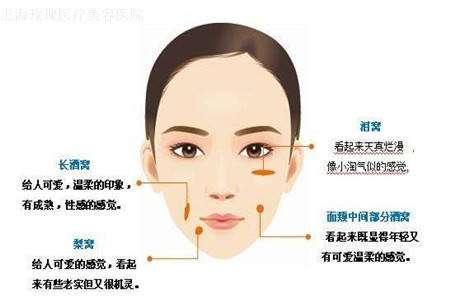 酒窝整形的价格及其相关因素探讨
