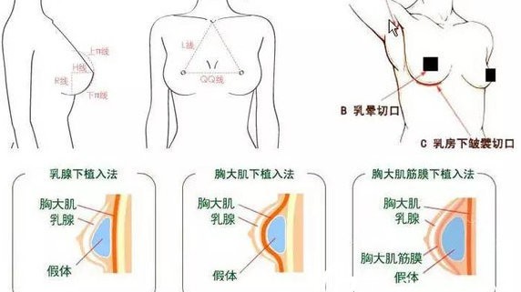 重塑女性魅力