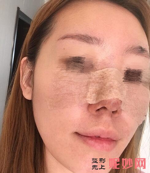 北京鼻部整形，重塑自信与美丽