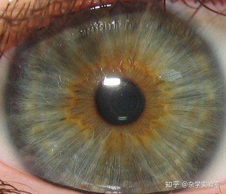双色瞳孔散大的神秘面纱